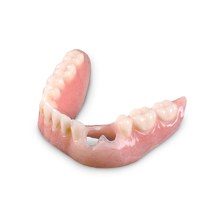 Dura-Sil™ Silicone Retained RPD Complete