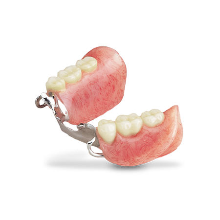 Titan® Milled Titanium Partial Dentures